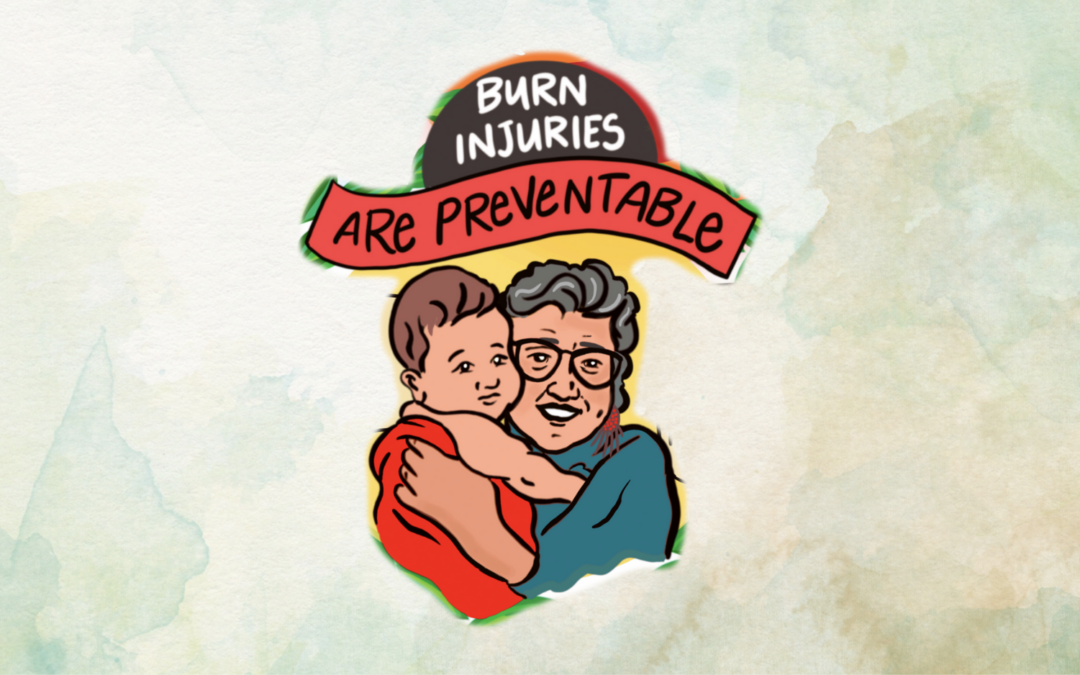 Burn Awareness Week 2024: Learn how to prevent burn injuries