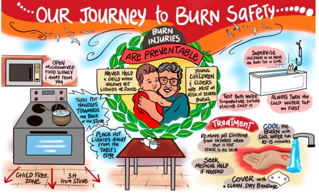 Our Journey to Burn Safety